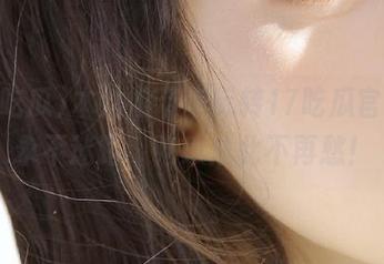 First Image